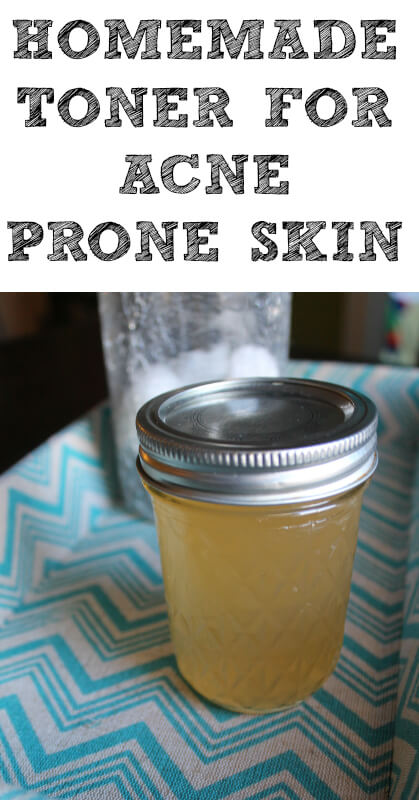 If your skin is acne prone like mine, use this homemade toner to help heal your acne!