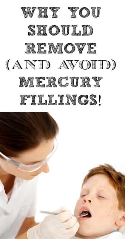 Why-You-Should-Remove-And-Avoid-Mercury-Fillings