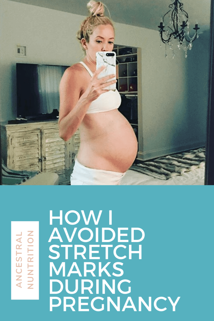 Learn how to prevent stretch marks during pregnancy by optimizing your nutrition and focusing on nutrient-dense and supportive foods like collagen. Learn the best kept secret tips for having a stretch mark free pregnancy and get the best collagen product plus smoothie recipe to help prevent the formation of stretch marks   #pregnancy #stretchmarks #collagen #nutrition #diet 