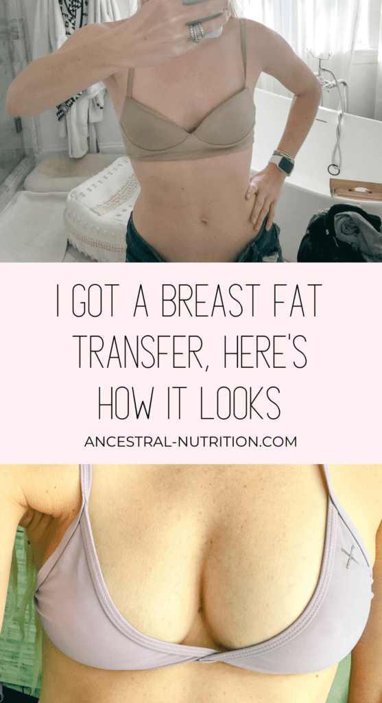  This health and fitness blogger shares her experience with breast augmentation with fat transfer procedure which she had done after breastfeeding several children. See her honest before and after shots, learn about pros and cons, risks and side effects,  and find out whether or not she regrets it #breastaugmentation #fattransfer #beforeandafter #makeover #plasticsurgery