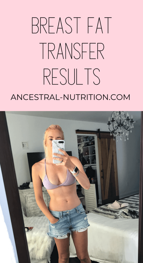 My Breast Fat Transfer Results - Ancestral Nutrition