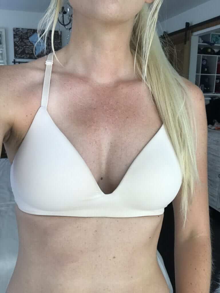 Bednar Cosmetic on X: Here's a Before & After of a Fat Transfer to the  breast patient just 2 months post op. Yep. She's very happy with her  results. And, Nope. She